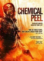 Chemical Peel 2014 film nackten szenen