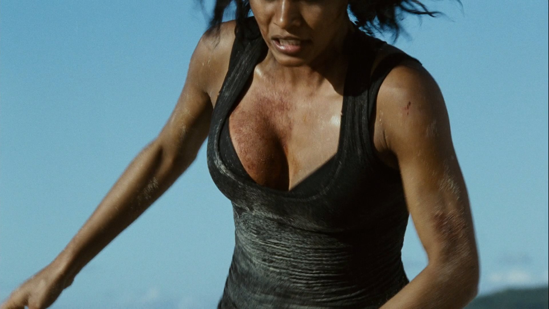 Emilia burns