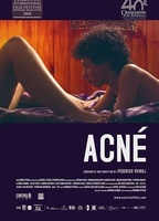 Acné (2008) Nacktszenen
