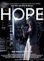 Hope (2016-heute) Nacktszenen